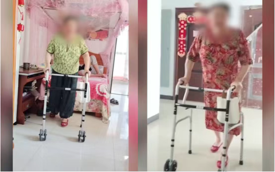 被“冻住”50多年的腿终于能走了！68岁阿婆僵直髋关节重生