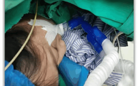 全身皮疹、血压骤降…73岁阿公麻醉药过敏，医生靠这个技术“避雷”！