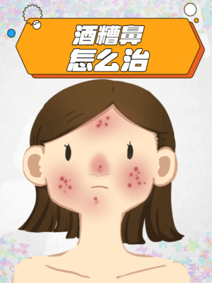别让“酒渣鼻”毁了颜值！警惕玫瑰痤疮这个“颜值小偷” | 健康肌秘