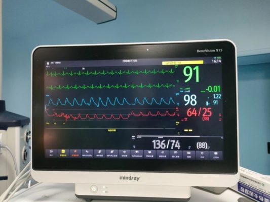 生死毫米间：九小时极限拆解“嗜铬炸弹”，海南医科大学第二附属医院多学科协作守护生命禁区