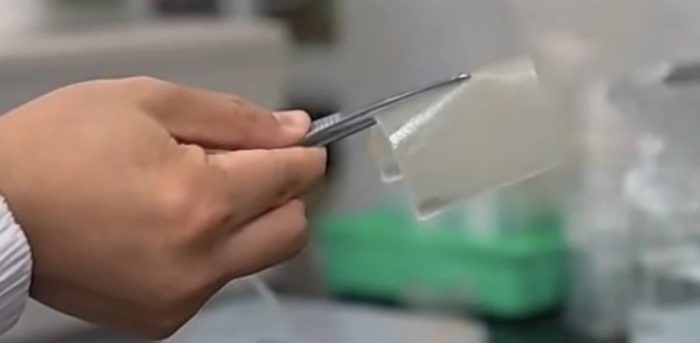 百岁阿婆从濒临截肢到独立行走，真相竟是……