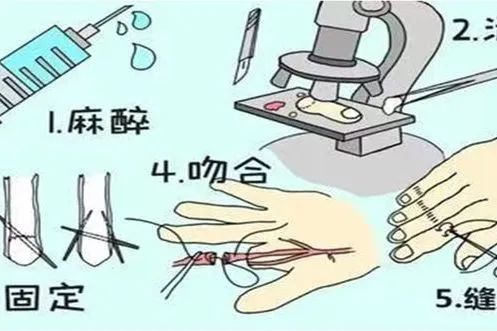 “手废了，家咋办？”