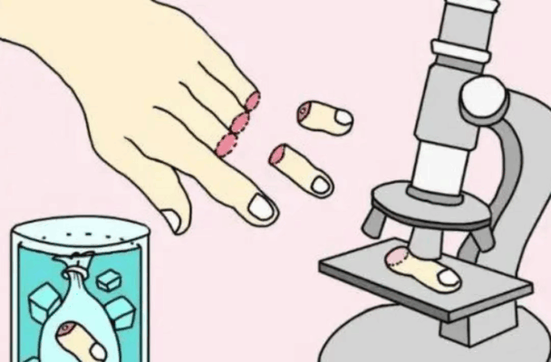 “手废了，家咋办？”