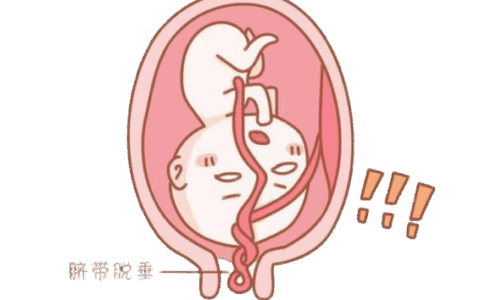 脐带脱垂命悬一线！海南省人民医院多学科8分钟“黄金救援”，守护新生希望