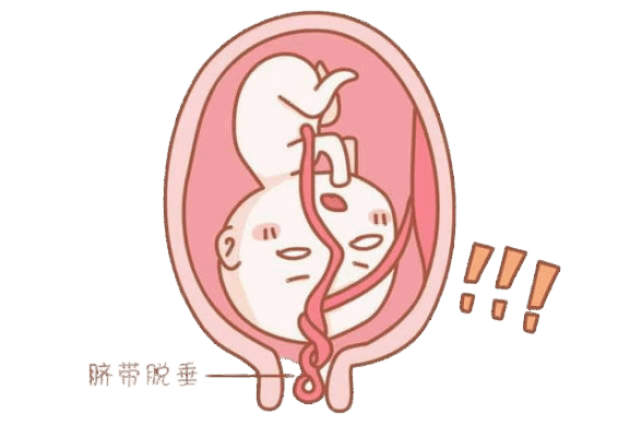 脐带脱垂命悬一线!海南省人民医院多学科8分钟“黄金救援”,守护新生希望