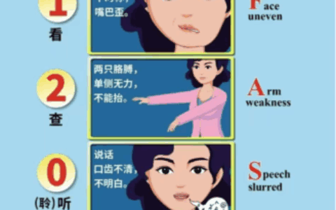 29岁女子突发脑梗！专家提醒这些信号要警惕