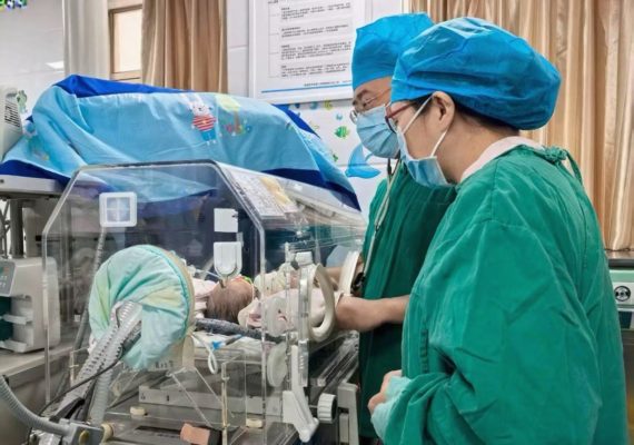 海医二院完成出生仅5天新生儿先天性会厌囊肿切除