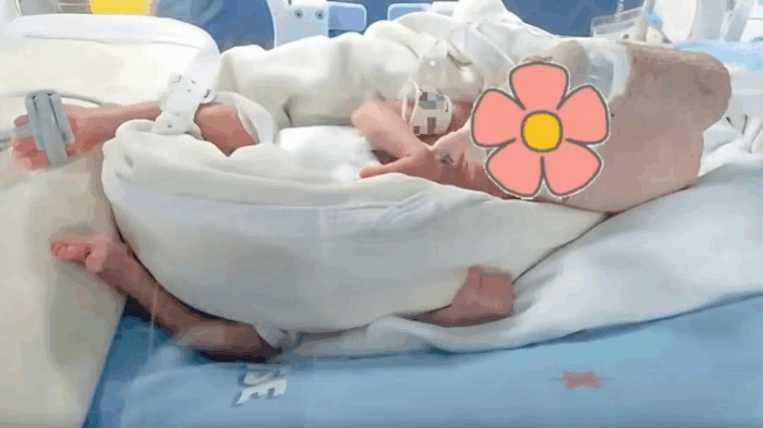 胎龄24周，救治137天！700g超早产儿顺利出院  现代妇儿新生儿救治水平再次刷新