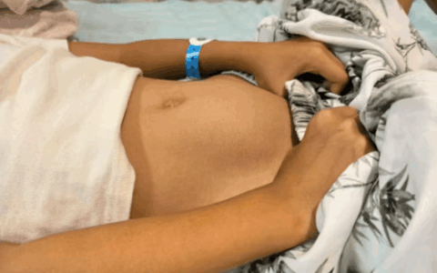 7岁女孩检出12cm卵巢肿瘤！单孔腹腔镜“隐痕”手术守护生育力