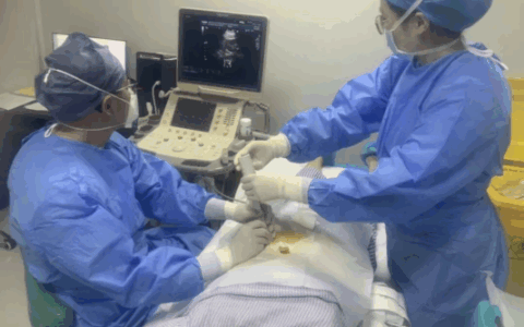 王东林：针尖上的“舞者”，以介入超声破壁生命难题