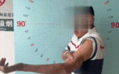 48年！他的左臂“冻住”半生，这台手术让手臂重获新生