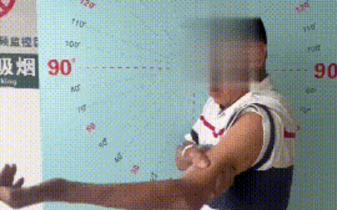 48年！他的左臂“冻住”半生，这台手术让手臂重获新生