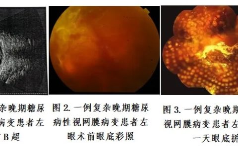 海南医科大学第一附属医院眼科医生的周末：显微镜下，为患者抢回“看见”的权利