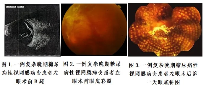 海南医科大学第一附属医院眼科医生的周末：显微镜下，为患者抢回“看见”的权利