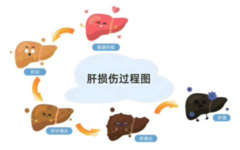 从跨海求医到返岛根治：高难度手术让六旬肝癌患者重获新生