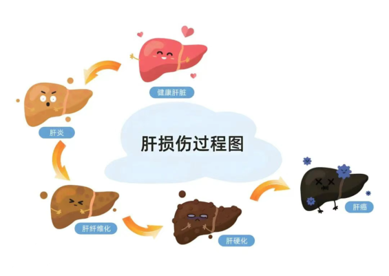 从跨海求医到返岛根治：高难度手术让六旬肝癌患者重获新生