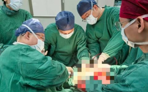 10公斤巨瘤占满女子腹腔，多学科接力精准“拆弹”