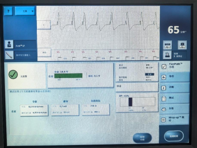 96岁奶奶心脏“停摆”5.3秒，一颗“小胶囊”让她重获“心声”