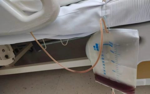 血压250、尿液酱油色...我院打破常规，成功救治危重HELLP综合征孕妇