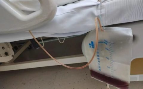 血压250、尿液酱油色…我院打破常规，成功救治危重HELLP综合征孕妇