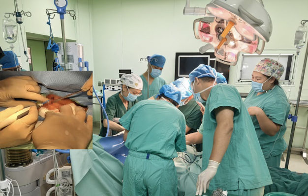 两分钟生死抢救！解放军总医院海南医院专家成功完成一例急性喉梗阻气管切开术