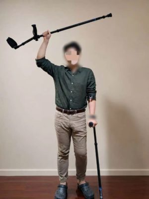 海南省人民医院运动医学科高效救治加拿大专家前交叉韧带撕裂