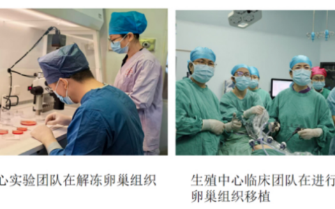 海南实现首例重型地贫患儿冻存卵巢组织自体移植