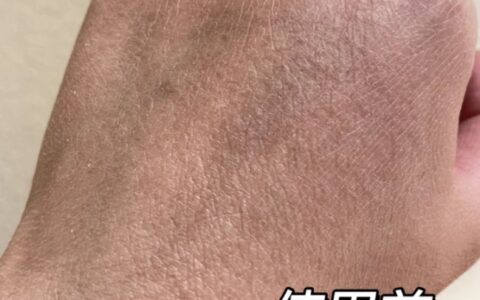 2026男士护手霜如何购买推荐品牌？告别干裂粗糙的终极选购指南