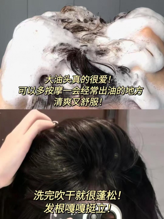 去屑止痒效果好的洗发水有哪些?2026好的洗发水