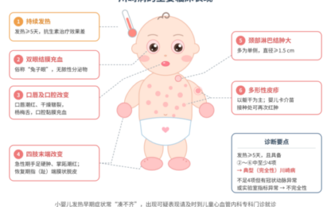 川崎病识别关口前移至新生儿期